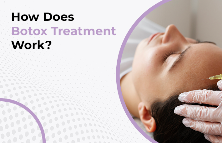 How Does Botox Treatment Work?