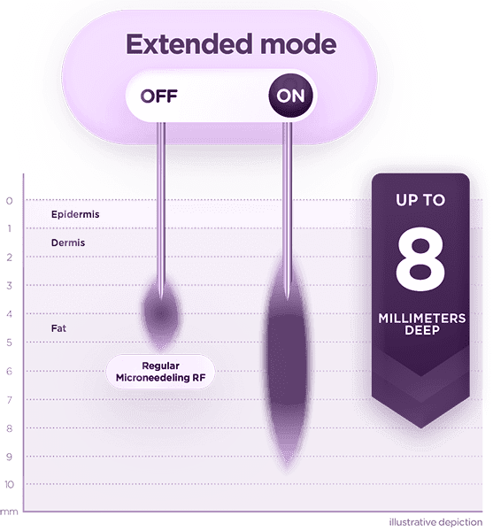 Exion