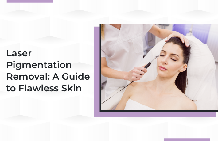 Laser Pigmentation Removal: A Guide to Flawless Skin