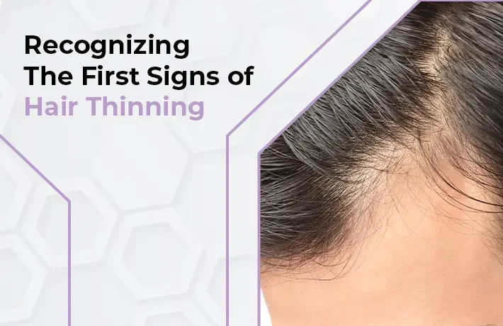 Recognizing The First Signs of Hair Thinning