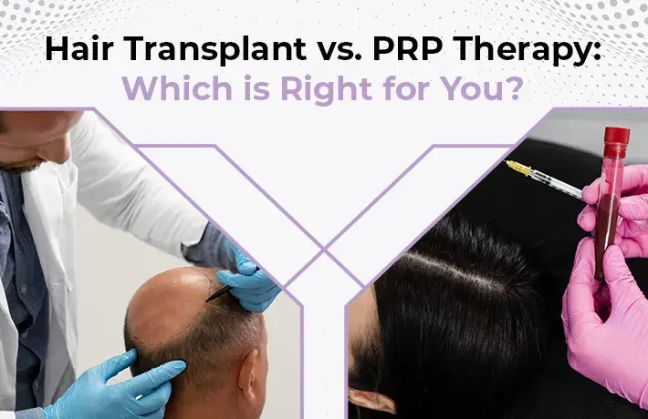 Hair Transplant vs. PRP Therapy: Which is Right for You?