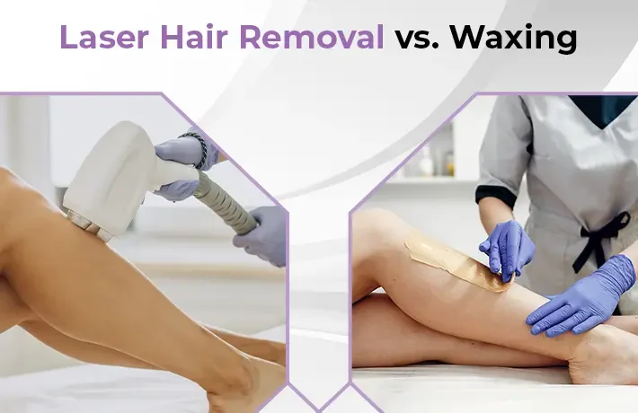 Laser Hair Removal vs. Waxing