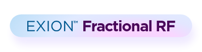 EXION Fractional RF