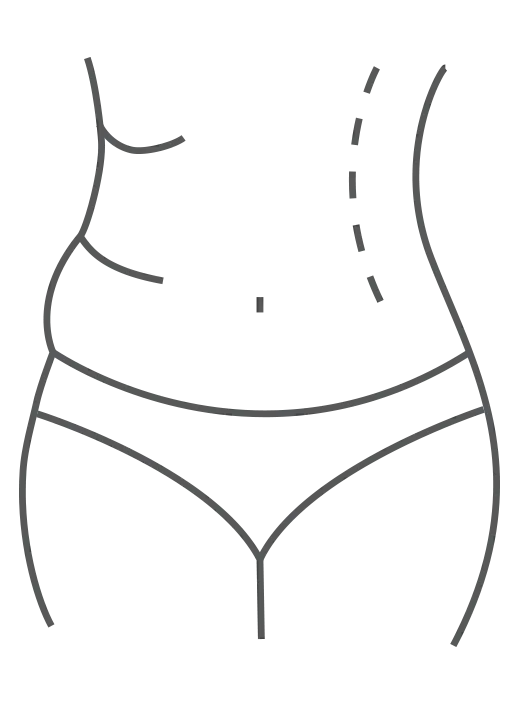 Inch Loss
