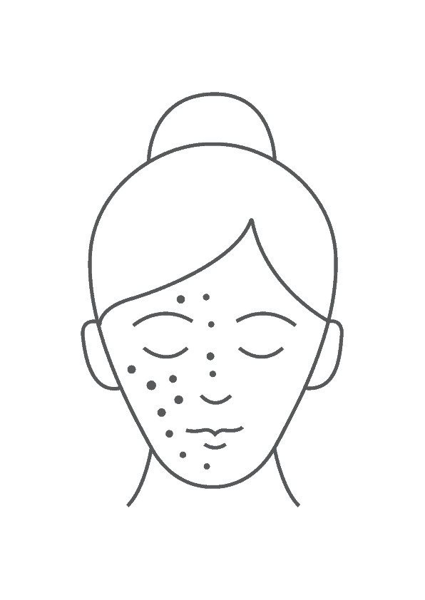 Cosmelan Peel