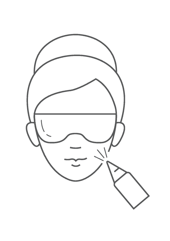 Pigment Laser
