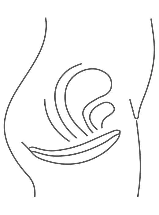 Pelvic Floor Strengthening