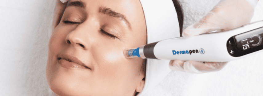 Derma Pen Treatment at Skuccii Supercliniq
