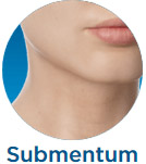 Submentum