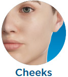 Cheeks
