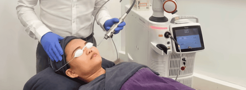 Fotona Laser Treatment at Skuccii Supercliniq