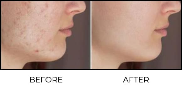 Skin polishing + whitening Before & After 6