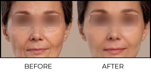 Skin polishing + whitening Before & After 7