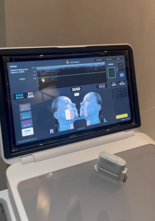 Ultherapy Prime Treatment at Skuccii Supercliniq