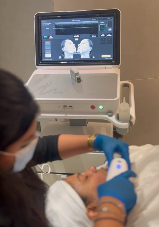 Ultherapy Prime Non-Surgical Skin Lifting