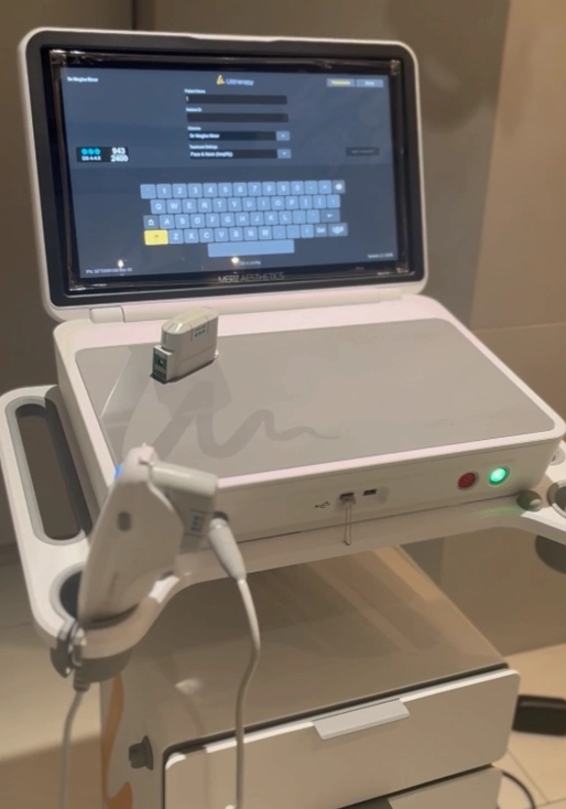 Ultherapy Prime DeepSEE Visualization