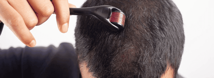 Dermaroller at Skuccii Supercliniq