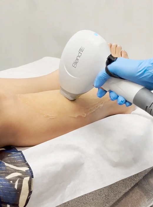 Laser Hair Removal