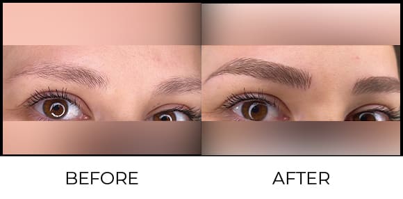 Microblading