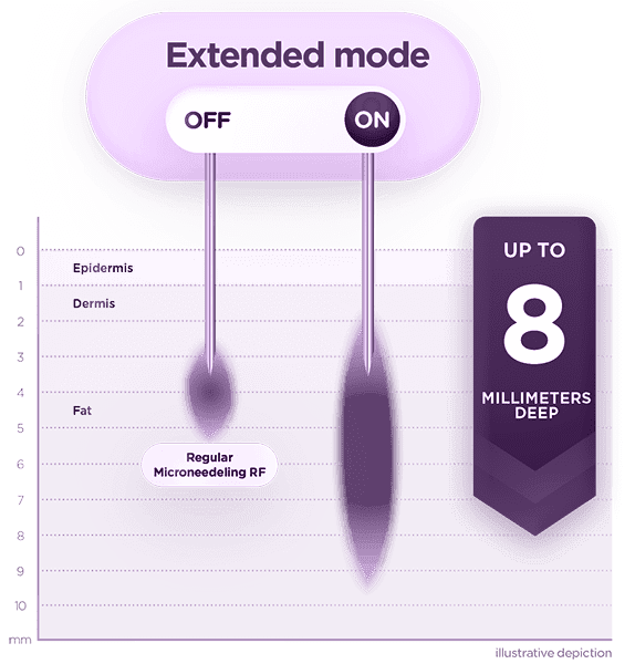 EXION_PIC_MOA_Fractional