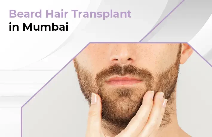 Hair transplant for patchy beard in Mumbai
