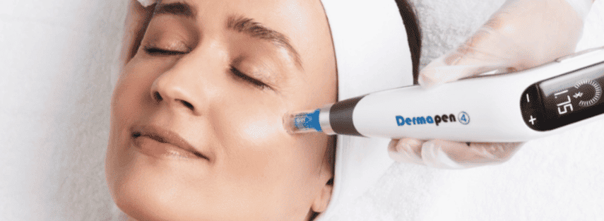 Derma pen (1)