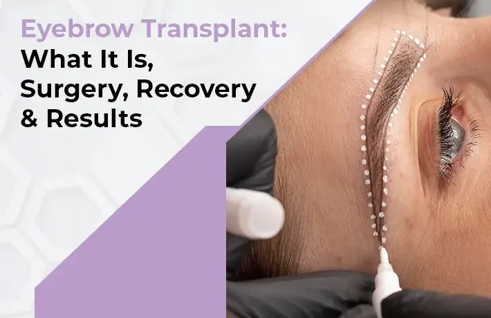 Eyebrow Hair Transplant Surgery in Mumbai
