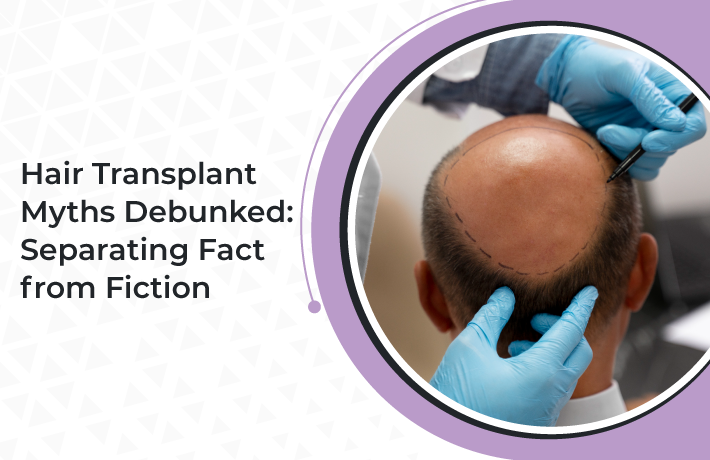 Hair Transplant Myths Debunked: Separating Fact from Fiction